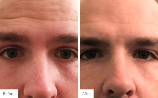 9 - Before and After Real Results image of a man's face.